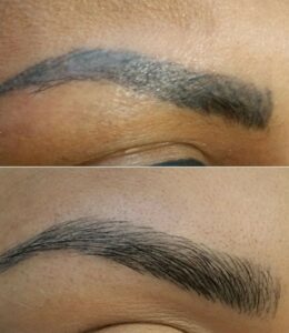 How to remove microblading eyebrows? How to fix a failed microblading