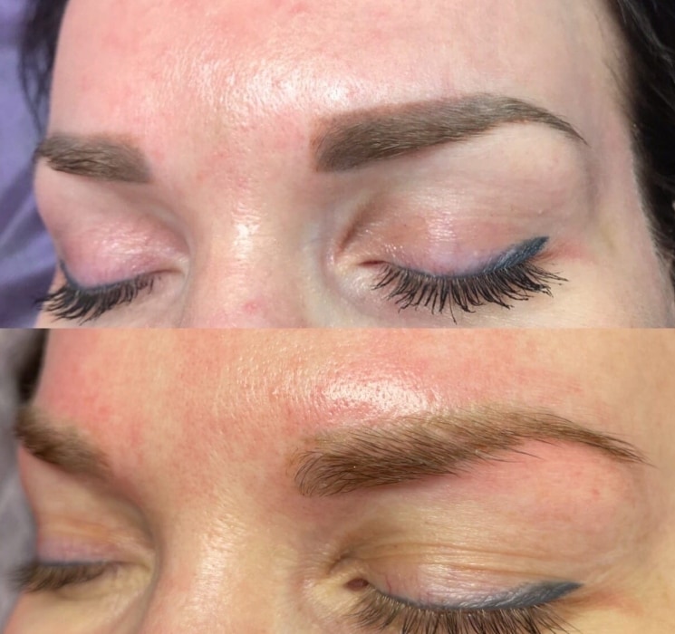 PERMANENT MAKEUP REMOVAL eyebrow makeup and microblading, before and after