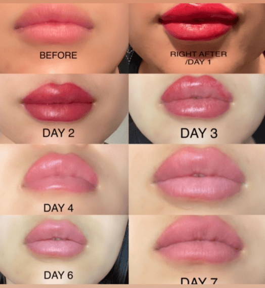 Immediate vs. Healed Results