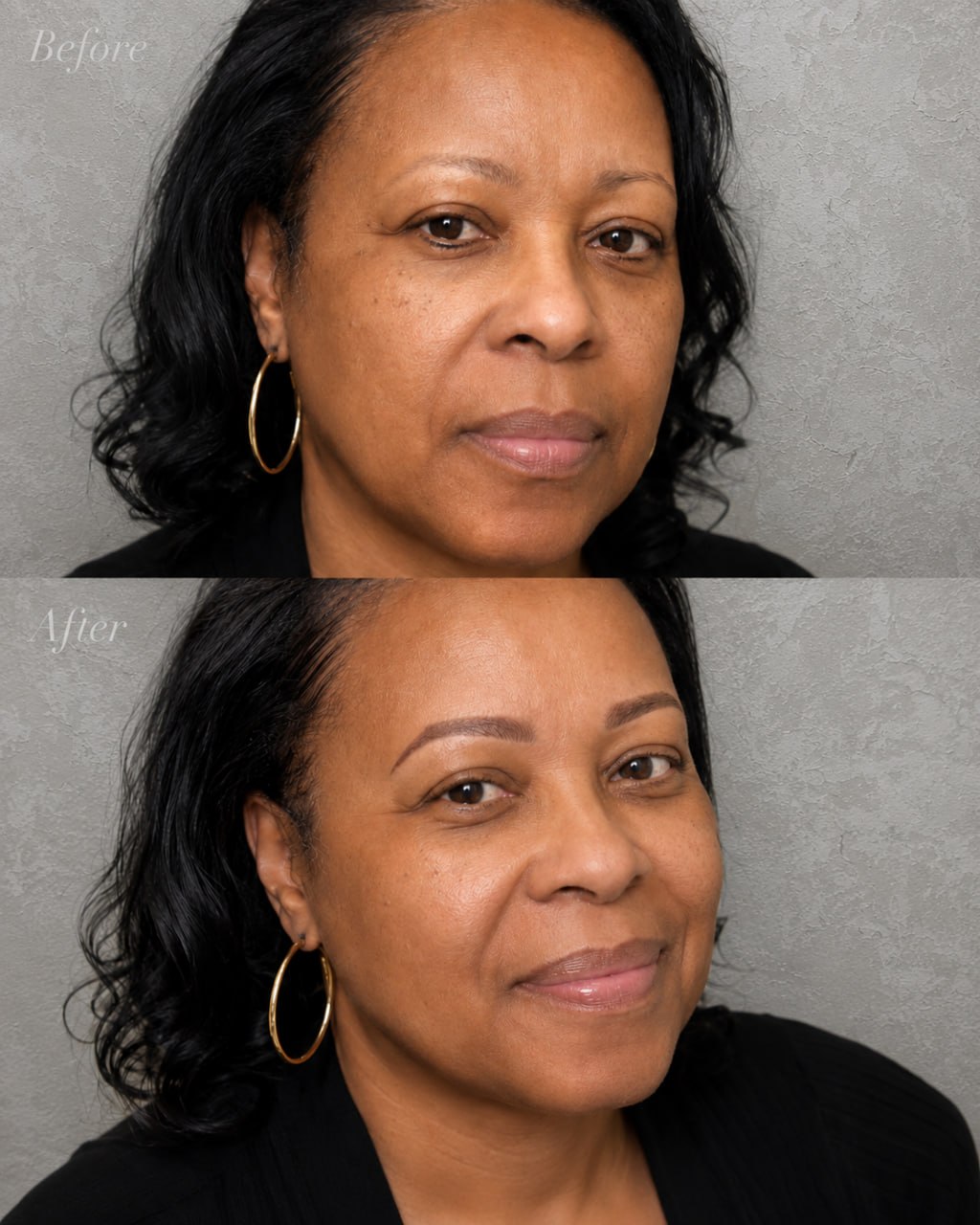EyebrowMicroblading-beforeafter1