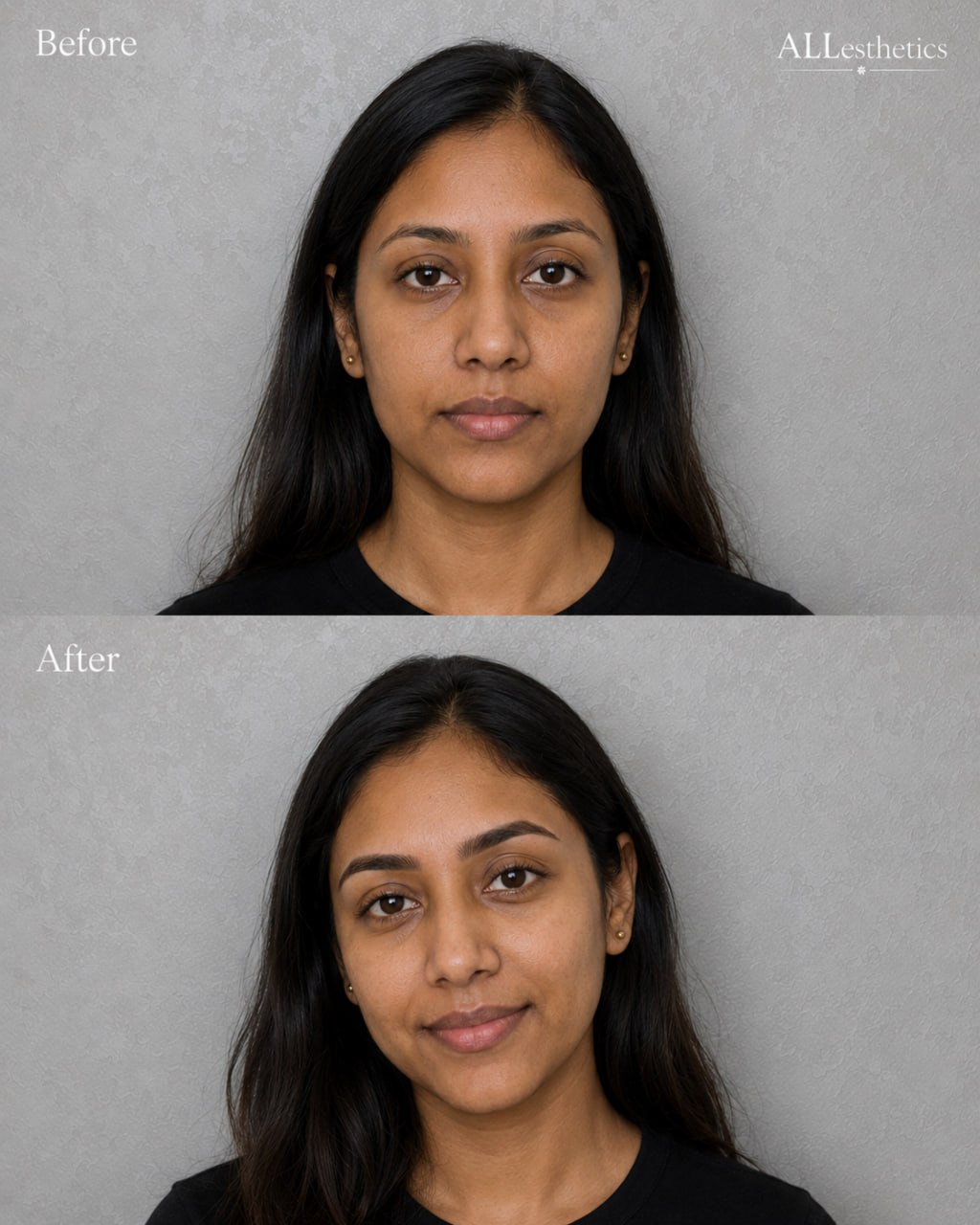 EyebrowMicroblading-beforeafter10
