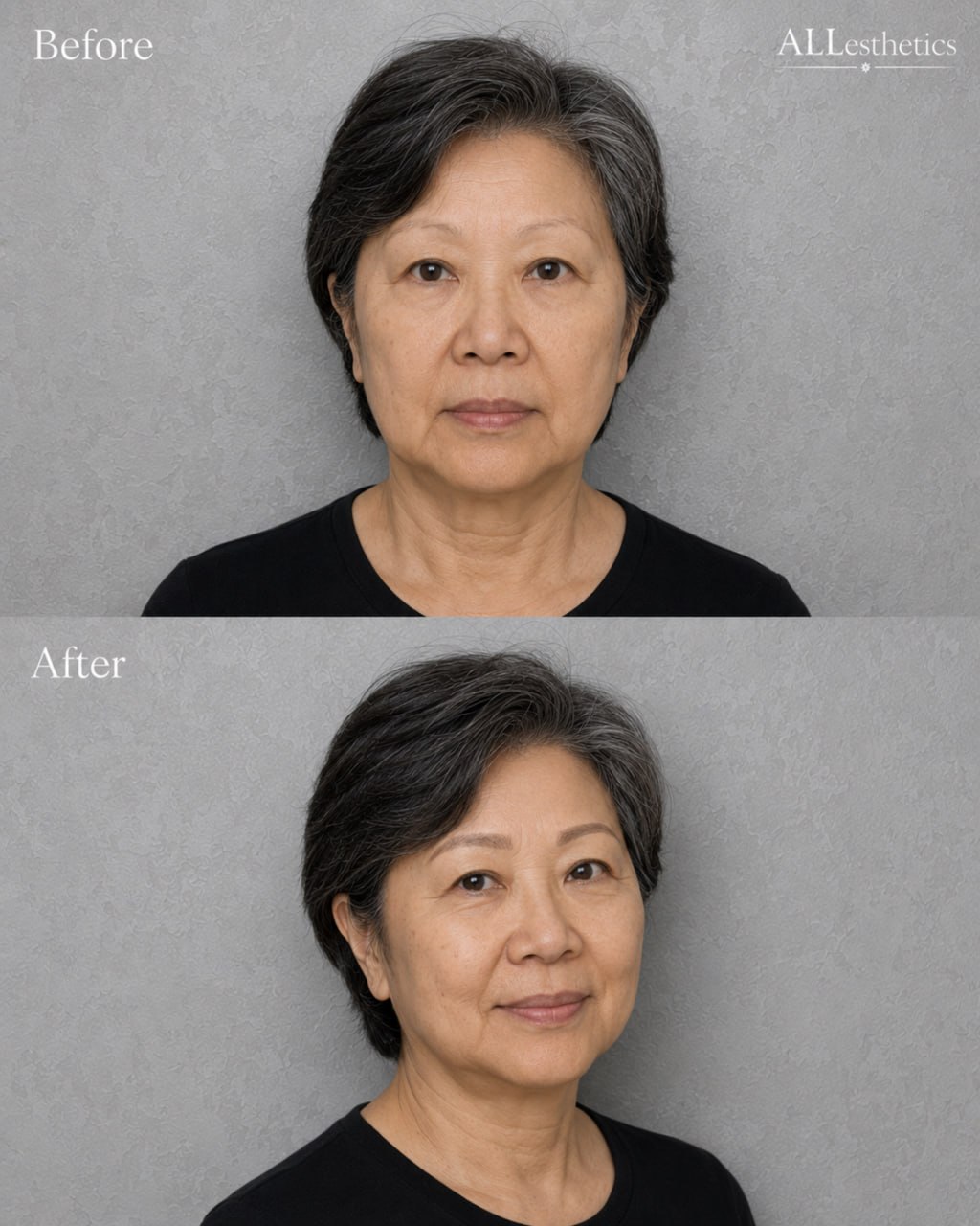 EyebrowMicroblading-beforeafter11