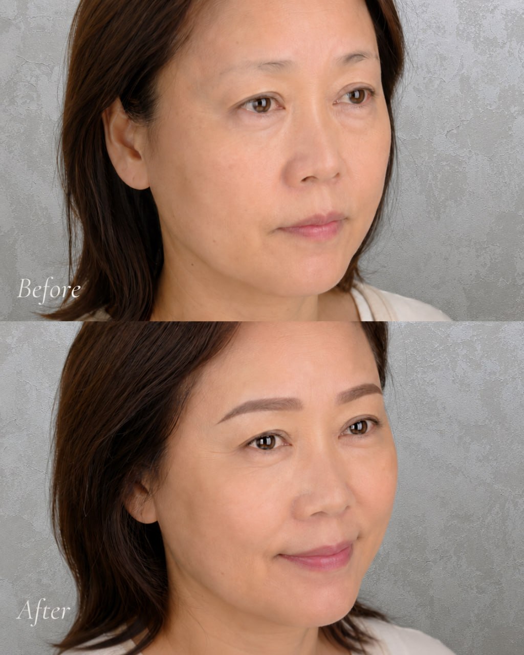 EyebrowMicroblading-beforeafter2