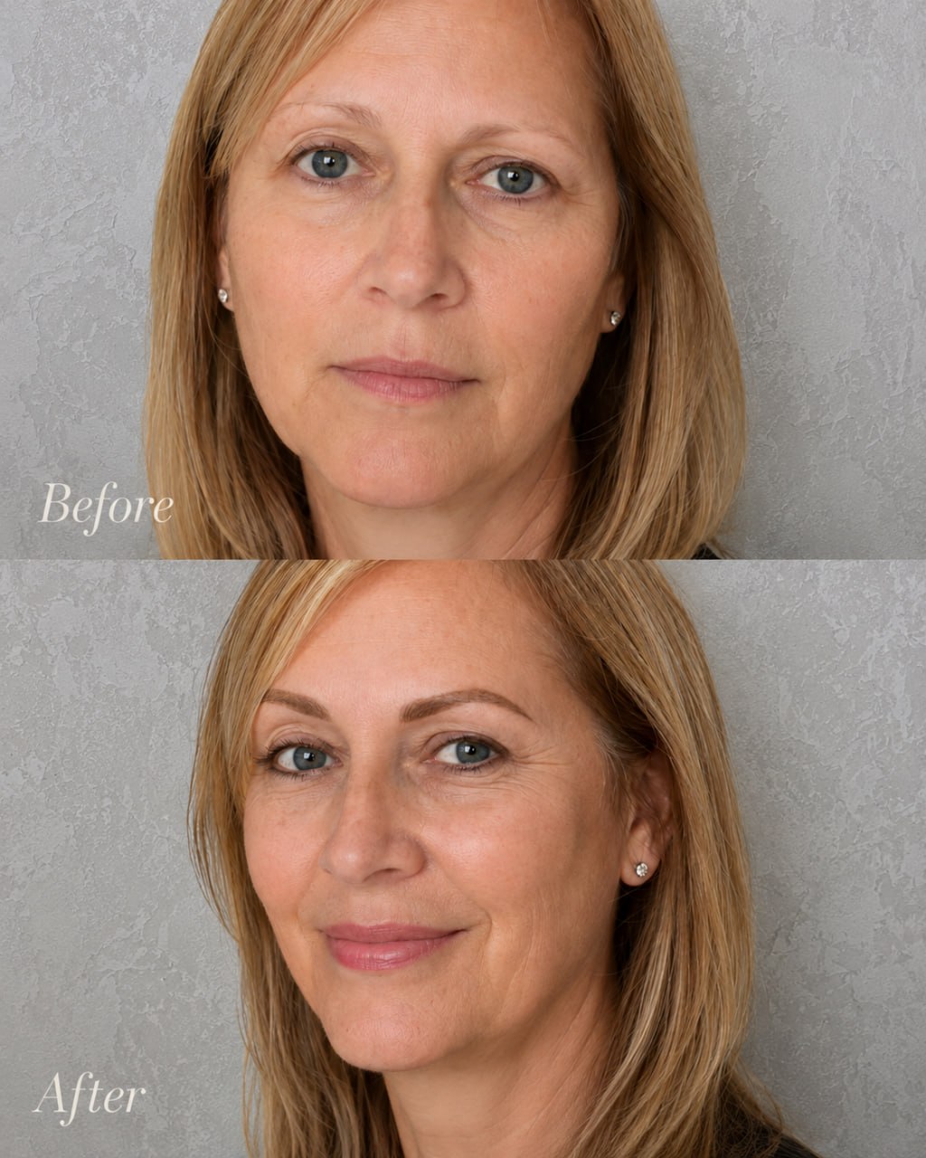 EyebrowMicroblading-beforeafter4