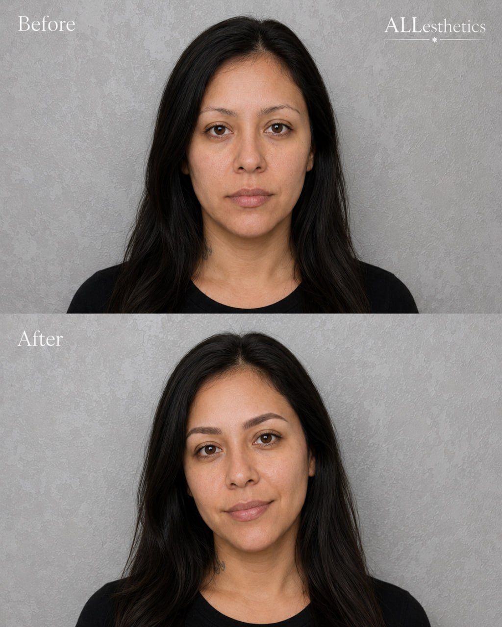 EyebrowMicroblading-beforeafter7