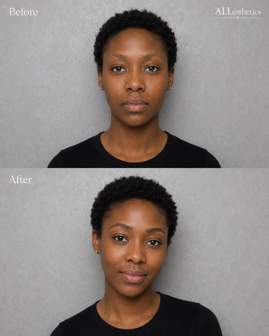 EyebrowMicroblading-beforeafter9