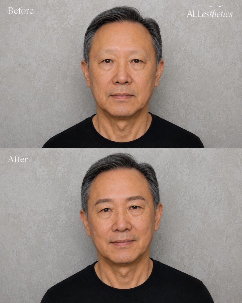 menEyebrowMicroblading-beforeafter2