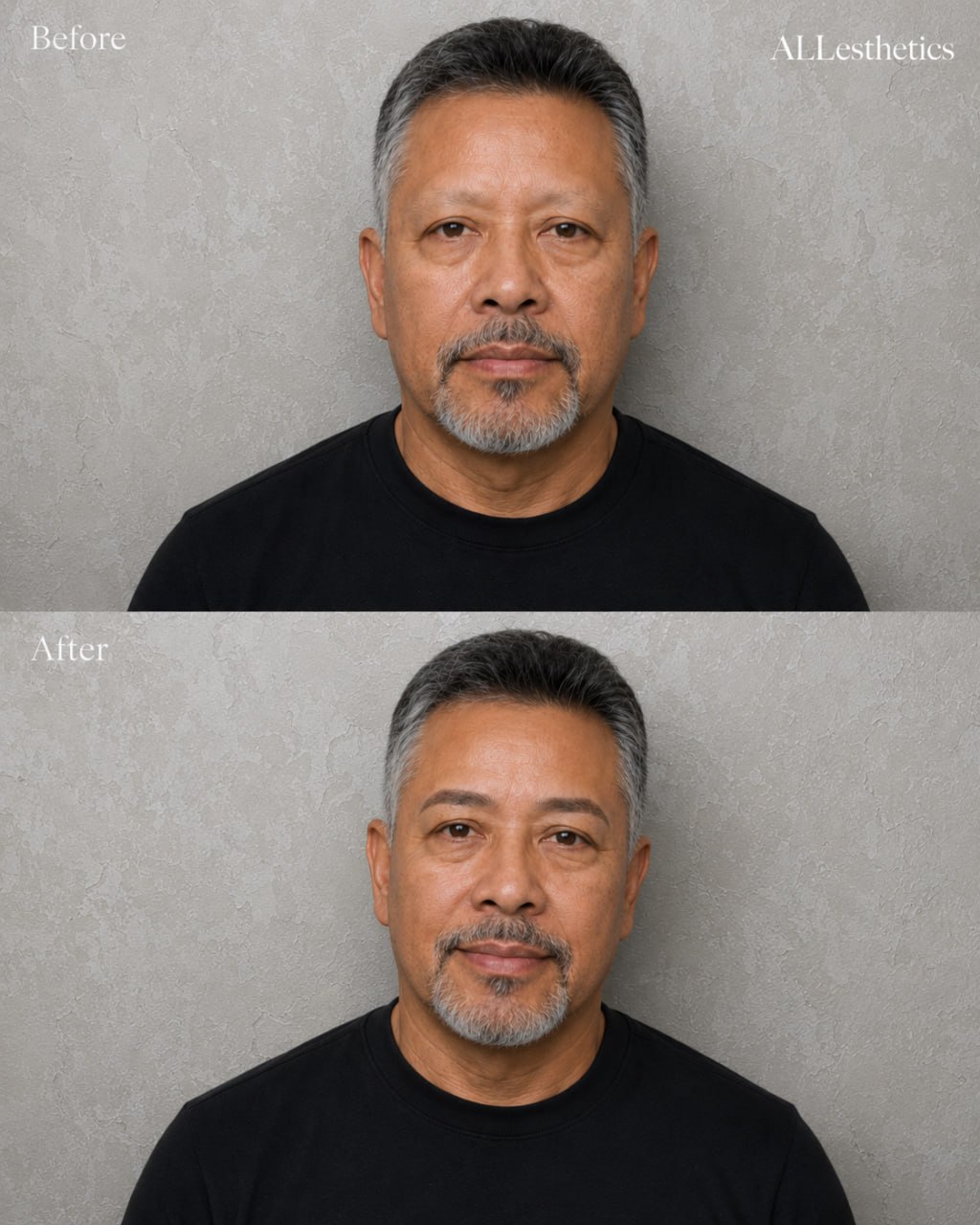 menEyebrowMicroblading-beforeafter3