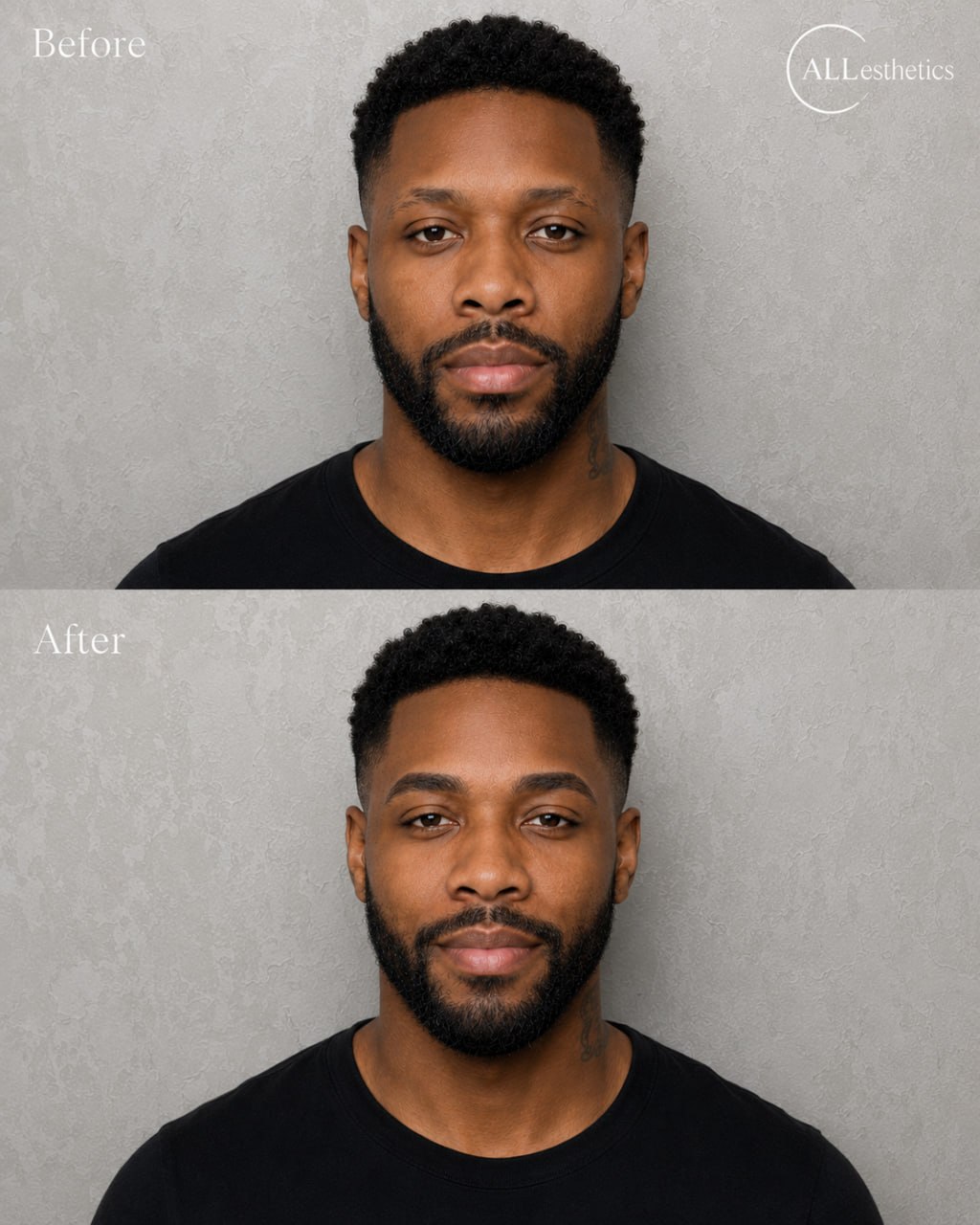 menEyebrowMicroblading-beforeafter4