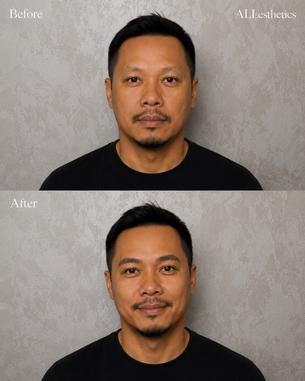 menEyebrowMicroblading-beforeafter5