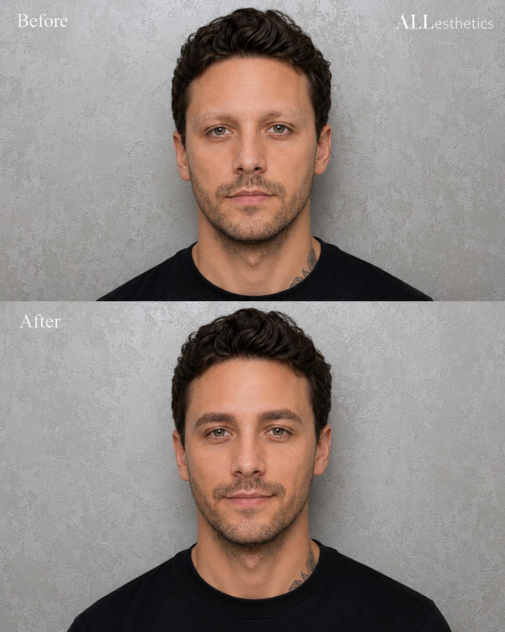 menEyebrowMicroblading-beforeafter6