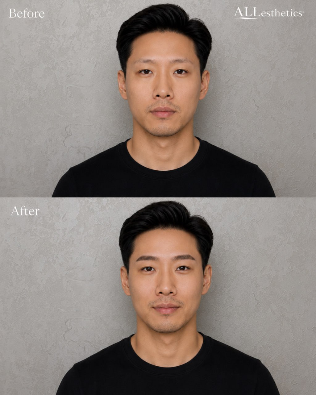 menEyebrowMicroblading-beforeafter7