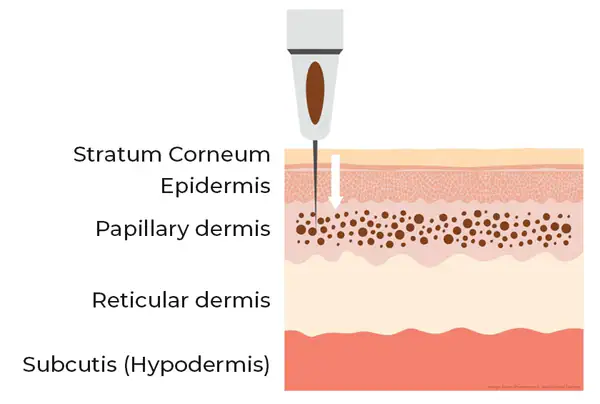 Identifying the Optimal Skin Layers for PMU Placement