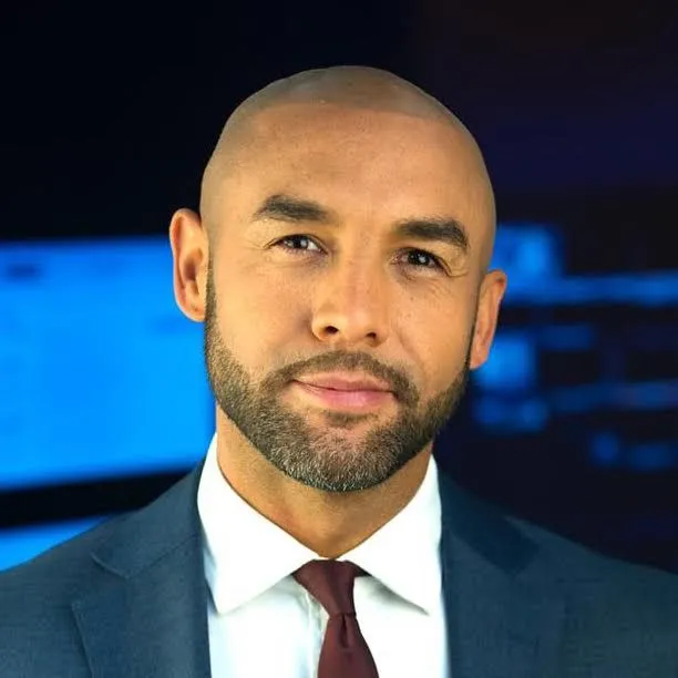 Alex Beresford scalp micropigmentation