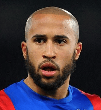Andros Townsend scalp micropigmentation