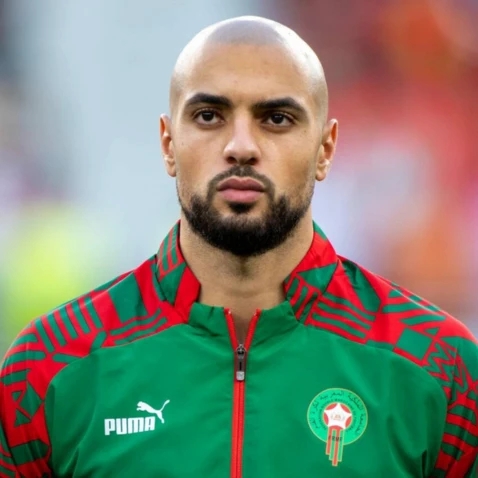 Sofyan Amrabat scalp micropigmentation