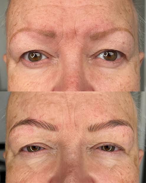 Microblading for Alopecia 2
