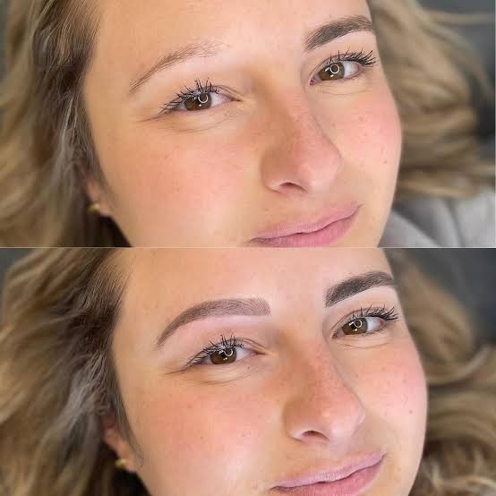 Microblading for Alopecia 3